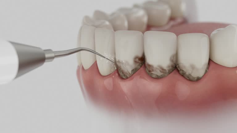 Trusted Teeth Cleaning And Checkup service in Citrus Park, FL - Dentist Open Now